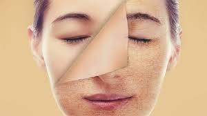 Kuru Cilde Karşı Ayurveda