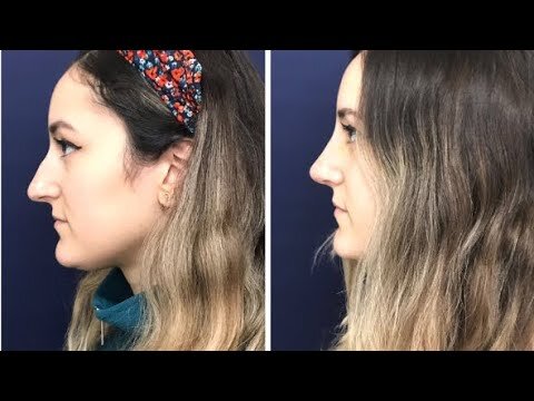 Devlet Hastanesinde Estetik Yapılır Mı?
