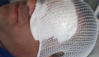 Sınır Kapısı’nda Darp Edildi
